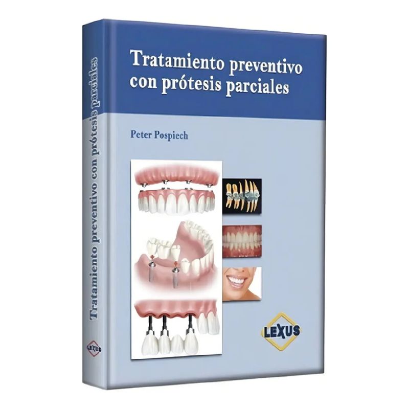 TRATAMIENTO PREVENTIVO CON PROTESIS PARCIALES - TD (Nuevo)