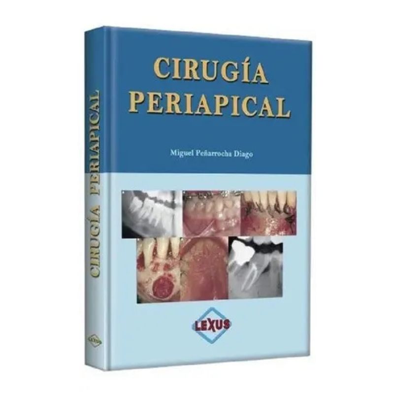CIRUGIA PERIAPICAL (Nuevo)