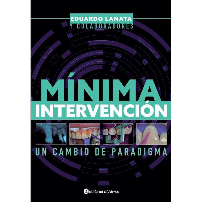 MINIMA INTERVENCION (Nuevo)