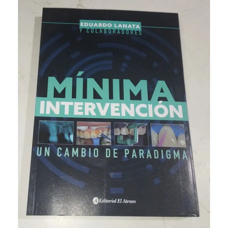 MINIMA INTERVENCION (Nuevo) - Miniatura 2