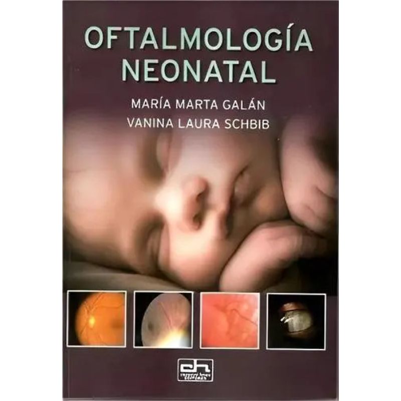 OFTALMOLOGIA NEONATAL (Nuevo)