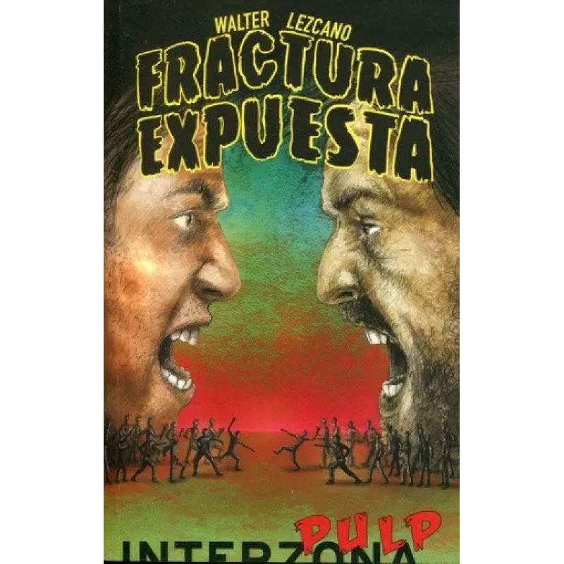 FRACTURA EXPUESTA (Nuevo)