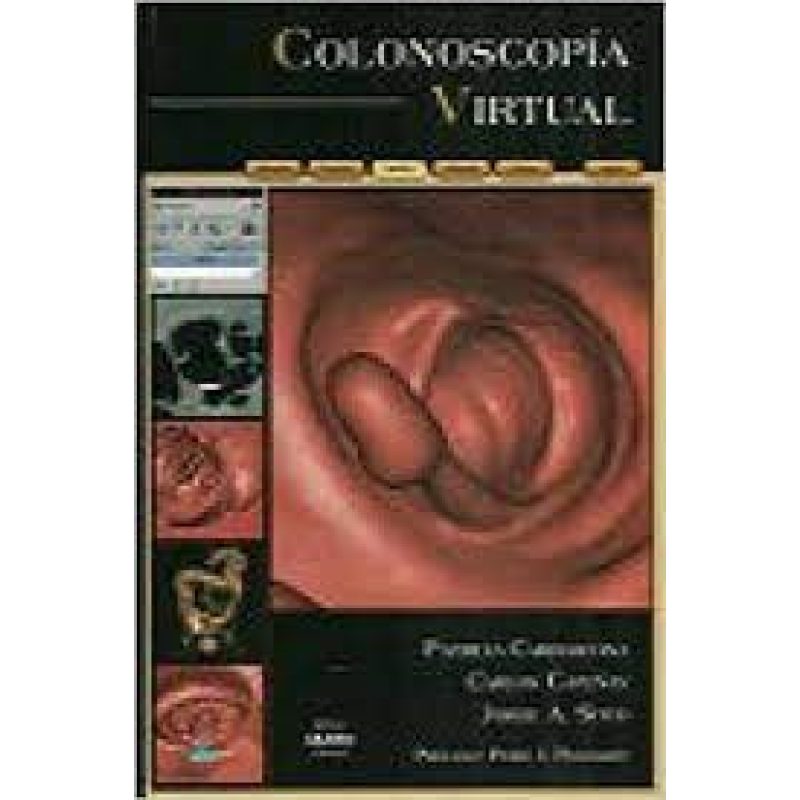 COLONOSCOPIA VIRTUAL (CARTONE)