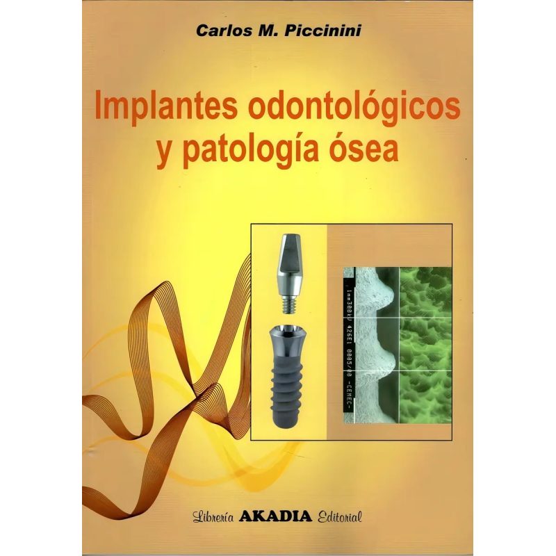 IMPLANTES ODONTOLOGICOS Y PATOLOGIA OSEA